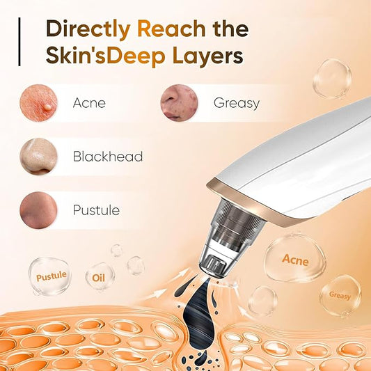 Electric Blackhead Remover & Pore Vacuum Cleaner